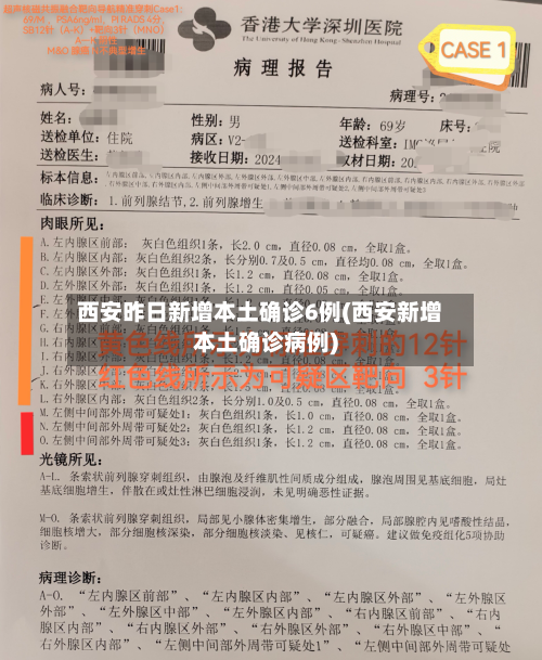 西安昨日新增本土确诊6例(西安新增本土确诊病例)-第2张图片