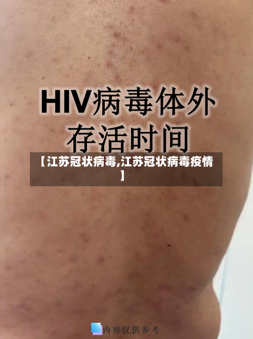 【江苏冠状病毒,江苏冠状病毒疫情】-第2张图片