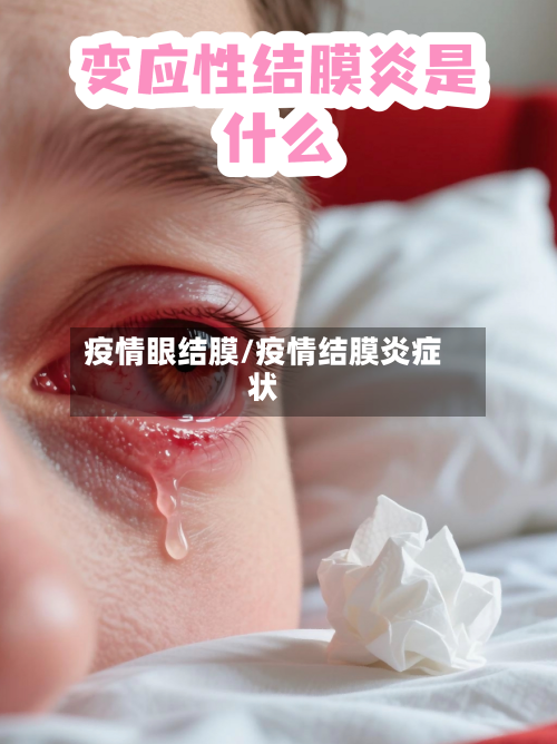 疫情眼结膜/疫情结膜炎症状-第3张图片