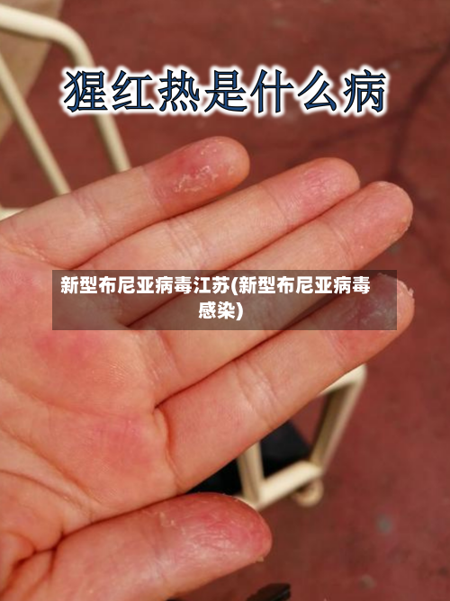 新型布尼亚病毒江苏(新型布尼亚病毒感染)-第1张图片